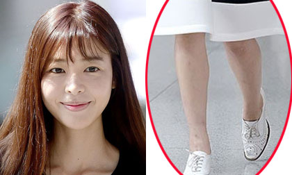 'Ác nữ' Kim Gyu Ri lộ đầu gối thâm và đôi chân đầy 'hoa gấm'