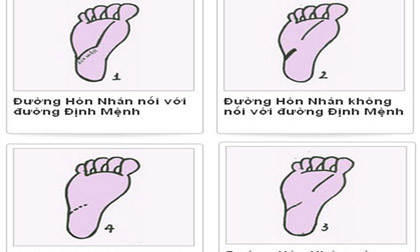 Bí mật đường hôn nhân ở lòng bàn chân