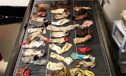 Phát hiện 43 chiếc tất trong dạ dày chú chó