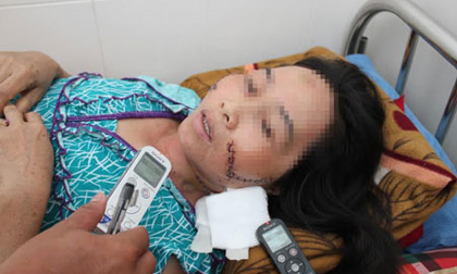 Phú Yên: Đòn đánh ghen kinh hoàng tình địch