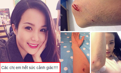 Diệp Lâm Anh bị trầy xước vì gặp cướp