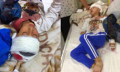 Không biết vẽ, 4 học sinh bị thầy giáo đánh đập dã man