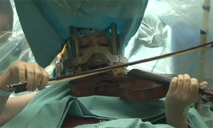 Ca phẫu thuật não độc nhất 