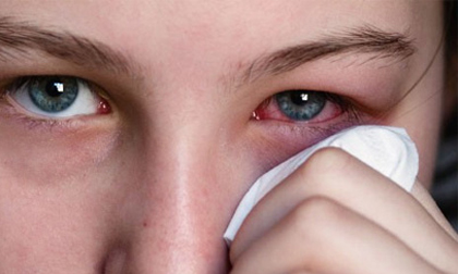 Tuyệt chiêu trị đau mắt đỏ hữu hiệu bằng khoai tây, mật ong