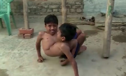 Clip sinh hoạt đời thường nhọc nhằn của 2 cậu bé dính liền