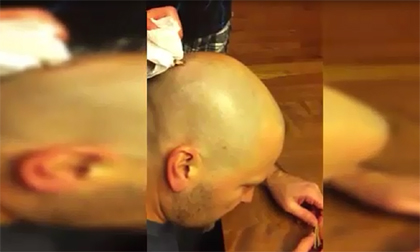 Rùng mình cảnh móc giun khổng lồ ký sinh trong đầu