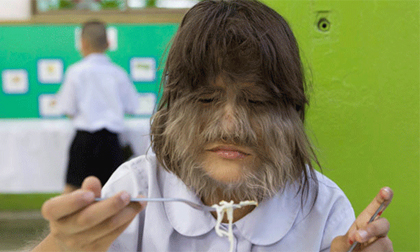 Kỳ dị: Cô bé lông sói, người phụ nữ có 3 bầu ngực