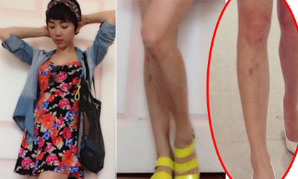 Tóc Tiên mất điểm vì chân đầy 'hoa gấm'