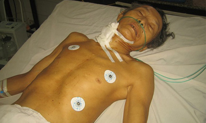 Cha đang ngủ say thì bị con trai kề dao cứa cổ