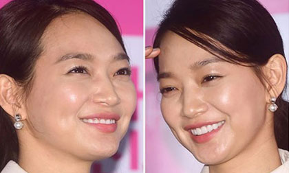 Shin Min Ah bị soi gương mặt bóng nhẫy như 'bôi mỡ' ở sự kiện