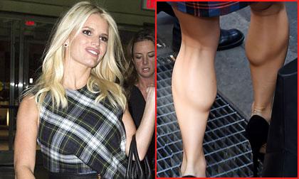 Jessica Simpson lộ bắp chân lồi lõm xấu xí