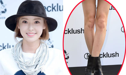 Lee Da Hee lộ chân tong teo và đầu gối xấu xí