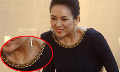 Chương Tử Di lộ hõm cổ xấu kỳ lạ như gốc cây