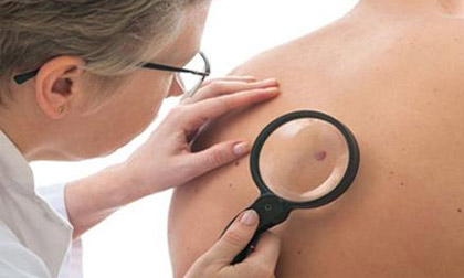 Có 5 dấu hiệu sau, đi khám ung thư ngay