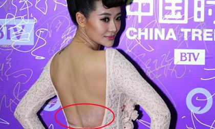 Người đẹp Ái Đới lộ lưng như bị "mốc"