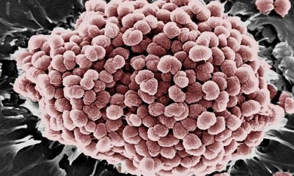 Mắc sùi mào gà, chồng suýt lao đầu vào ô tô tự tử