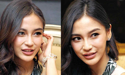 Angela Baby bị soi mặt cứng đờ, môi sưng phồng