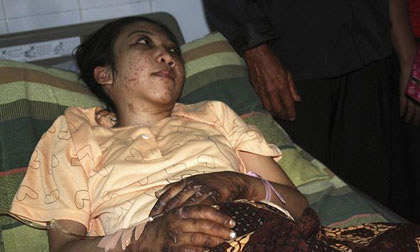 Hong Kong chấn động vụ Osin bị chủ tra tấn dã man