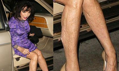 Sao 81 tuổi diện váy ngắn "khoe" da chân như 'xác khô'