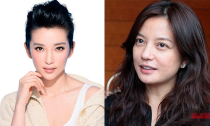 Khuyết điểm xấu không thể phẫu thuật của sao