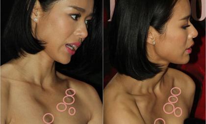 "Vết tích" khó hiểu chạy dọc trên ngực Hồ Hạnh Nhi