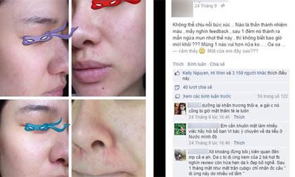 Cô gái khốn khổ vì mua kem trộn kém chất lượng trên mạng