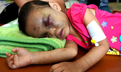 Những vụ cha mẹ bạo hành con chấn động Việt Nam