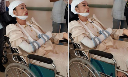 Giật mình ảnh Thanh Hằng bị 'tai nạn' nghiêm trọng