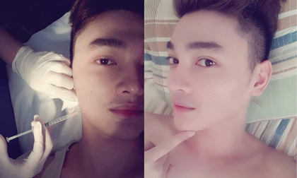 'Gà cưng' của Phi Thanh Vân khoe ảnh tiêm cằm V-line 