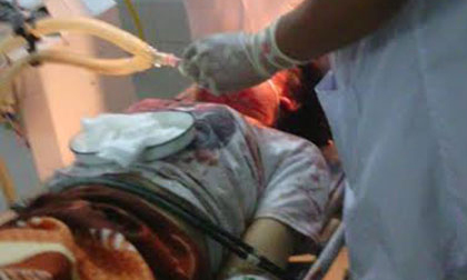 Bé gái 14 tuổi bị đánh vô cùng dã man trong đêm