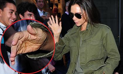 Vic lộ đường chỉ tay nhăn như 'mạng nhện'