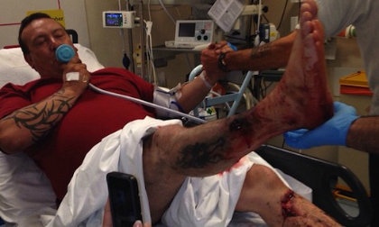 Xém mất mạng vì thuốc lá điện tử phát nổ như lựu đạn