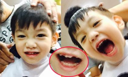 Subeo khoe răng sún cực yêu trong lúc cắt tóc