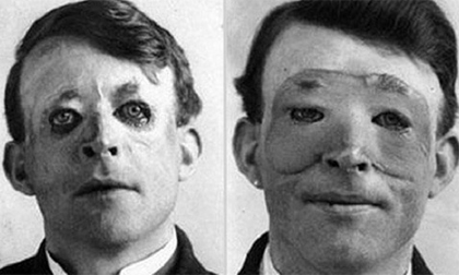 Những bức ảnh gây chú ý, khó tin trong lịch sử