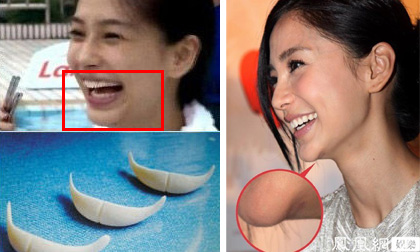 Angela Baby lộ rõ cằm độn khi cười