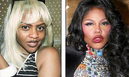 Gương mặt thay đổi 'chóng mặt' vì thẩm mỹ của Sao