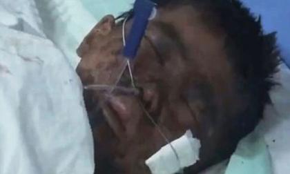 Dì ghẻ đánh đập, siết cổ, vứt con chồng vào hố than