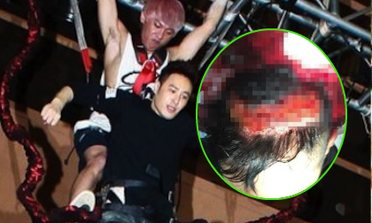 Ca sĩ Đài Loan bị chấn thương, đầu ngập trong máu