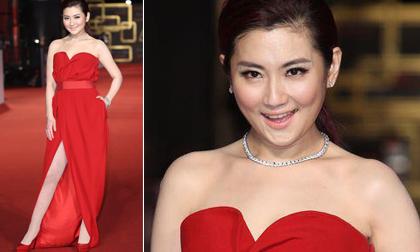 Selina lần đầu khoe vai và chân trần sau vụ tai nạn bỏng