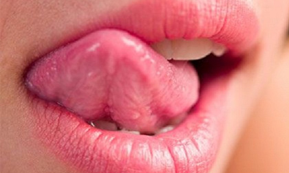 Đoán bệnh qua những đặc điểm khác thường của lưỡi