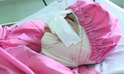 Ông lão 79 tuổi cắt tai, môi, mũi người yêu vì ghen