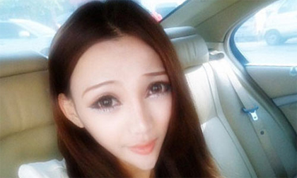 3 kiểu phẫu thuật thẩm mỹ nguy hiểm, rùng rợn nhất