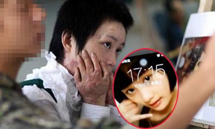 Chùm ảnh: Tuổi thanh xuân bị thiêu đốt của cô gái trẻ