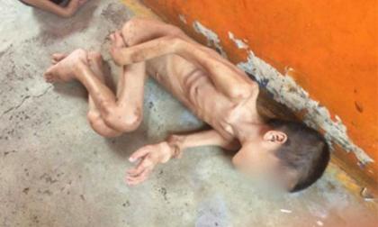 Bàng hoàng bức ảnh cậu bé gầy giơ xương nằm co ro trên đất