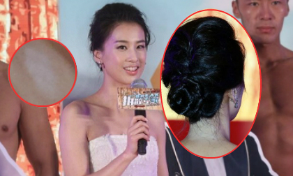  Huỳnh Thánh Y lộ lưng lốm đốm như 'mốc' 