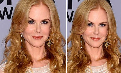 'Thiên nga Úc' lộ gương mặt đơ như tượng sáp