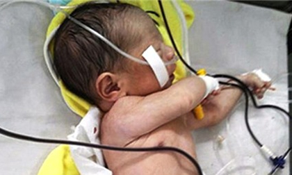 Nỗi đau phía sau vụ tai nạn khiến thai nhi văng khỏi bụng mẹ