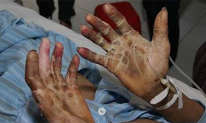 Những món ăn khoái khẩu nhưng nguy hại cho sức khoẻ