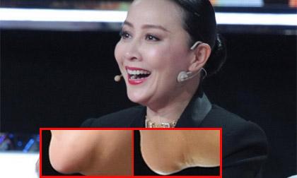 Lưu Gia Linh bị nghi độn cằm vì lộ vết tích lạ