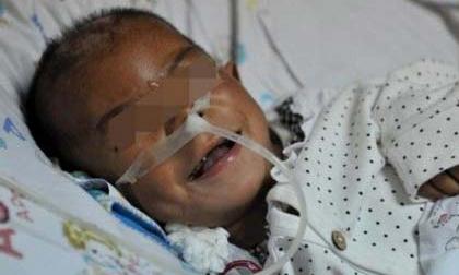 Nhốt trong chuồng lợn, bé 8 tuổi chỉ nặng 7kg